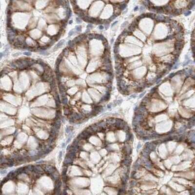 Immunohistochemistry-Paraffin: RNMTL1 Antibody [NBP1-83845]