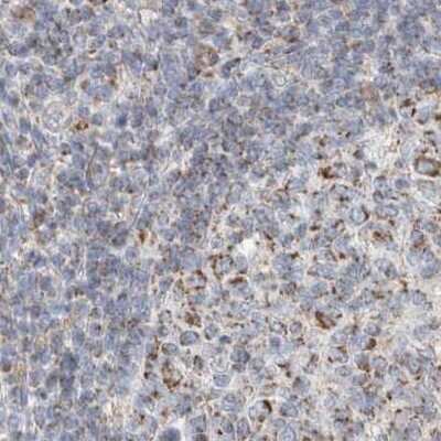 Immunohistochemistry-Paraffin: RNMTL1 Antibody [NBP1-83845]