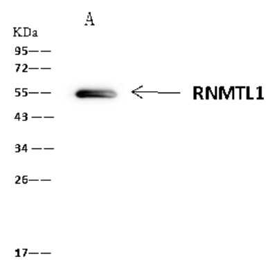 Immunoprecipitation: RNMTL1 Antibody [NBP2-98513]