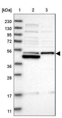 Western Blot: RNMTL1 Antibody [NBP1-83843]