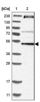 Western Blot: RNMTL1 Antibody [NBP1-83845]