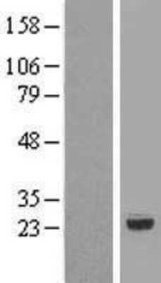 Western Blot: RNMTL1 Overexpression Lysate [NBP2-06866]