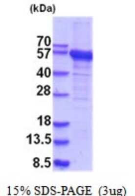 SDS-PAGE: Recombinant Human RNMTL1 His Protein [NBP2-52041]