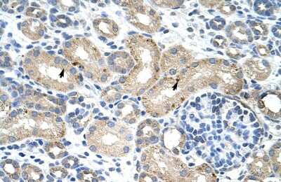 Immunohistochemistry-Paraffin: RNPC1 Antibody [NBP2-86780]