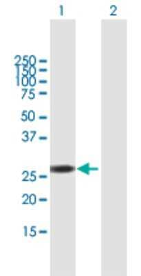 Western Blot: RNPC1 Antibody [H00055544-B02P]