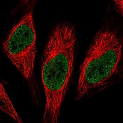 Immunocytochemistry/ Immunofluorescence: RNPC3 Antibody [NBP2-57100]