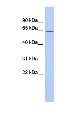 Western Blot: RNPC3 Antibody [NBP1-57138]