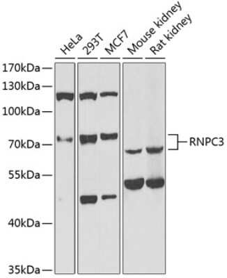 Western Blot: RNPC3 AntibodyBSA Free [NBP2-93867]