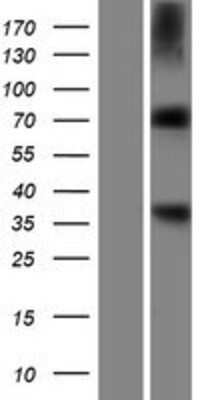 Western Blot: Aminopeptidase B/RNPEP Overexpression Lysate [NBP2-06674]