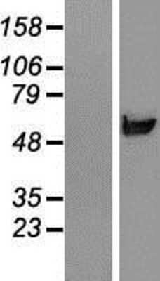 Western Blot: RNPEPL1 Overexpression Lysate [NBP2-06845]