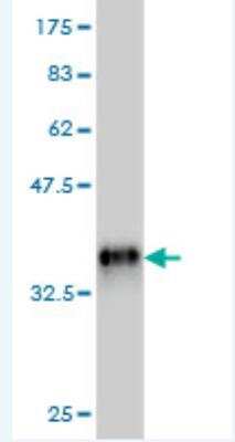 Western Blot: RNPS1 Antibody (2G11) [H00010921-M04]