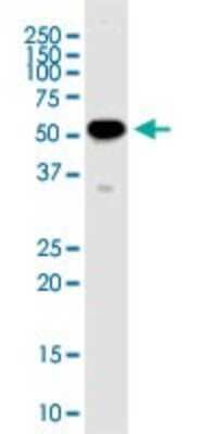Western Blot: RNPS1 Antibody (7G8) [H00010921-M05]