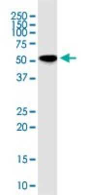 Western Blot: RNPS1 Antibody (7G8) [H00010921-M05]