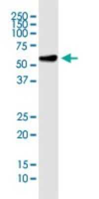 Western Blot: RNPS1 Antibody (7G8) [H00010921-M05]
