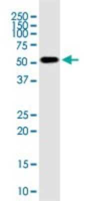 Western Blot: RNPS1 Antibody (7G8) [H00010921-M05]