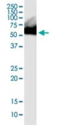 Western Blot: RNPS1 Antibody (7G8) [H00010921-M05]