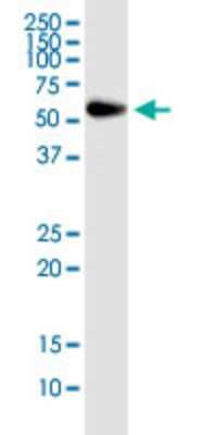 Western Blot: RNPS1 Antibody (7G8) [H00010921-M05]
