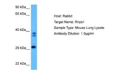 Western Blot: RNPS1 Antibody [NBP2-88169]