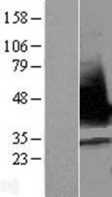 Western Blot: RNPS1 Overexpression Lysate [NBL1-15470]