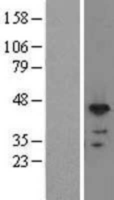 Western Blot: RNPS1 Overexpression Lysate [NBL1-15471]