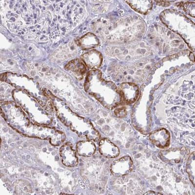 Immunohistochemistry: RNase H1 Antibody [NBP2-38501]