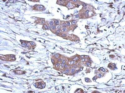 Immunohistochemistry-Paraffin: RNase H1 Antibody [NBP2-20171]