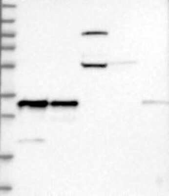 Western Blot: RNase H1 Antibody [NBP3-17926]