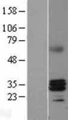 Western Blot: RNase H1 Overexpression Lysate [NBL1-15399]