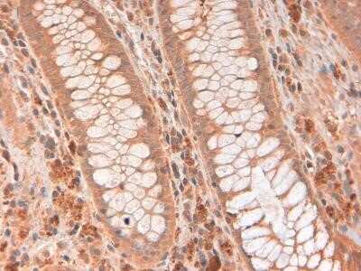 Immunohistochemistry: RNase L Antibody (2E9) - Azide and BSA Free [NBP2-80929]
