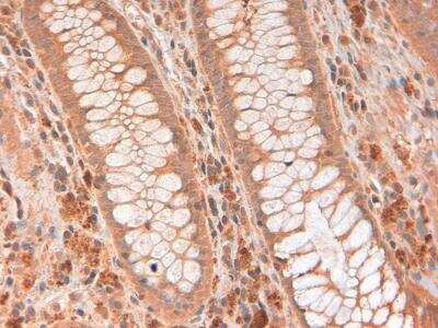 Immunohistochemistry: RNase L Antibody (2E9) - BSA Free [NB100-351]