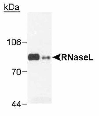 Western Blot: RNase L Antibody (2E9)BSA Free [NB100-351]