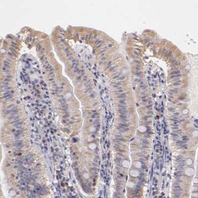 Immunohistochemistry-Paraffin: RNase L Antibody [NBP1-87230]