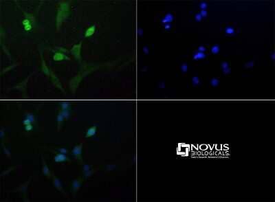 Immunocytochemistry/ Immunofluorescence: ROBLD3 Antibody [NBP1-71687]