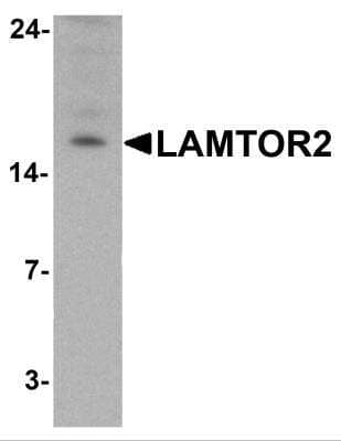 Western Blot: ROBLD3 AntibodyBSA Free [NBP2-81696]