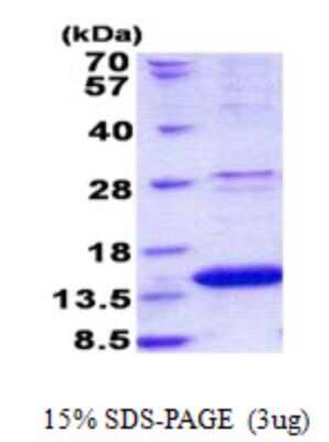 SDS-PAGE: Recombinant Human ROBLD3 His Protein [NBP2-23179]