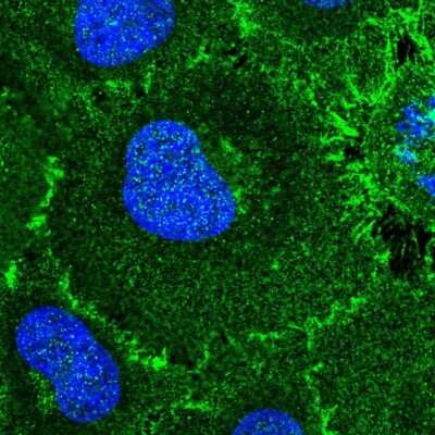 Immunocytochemistry/ Immunofluorescence: ROBO1 Antibody [NBP2-55652]