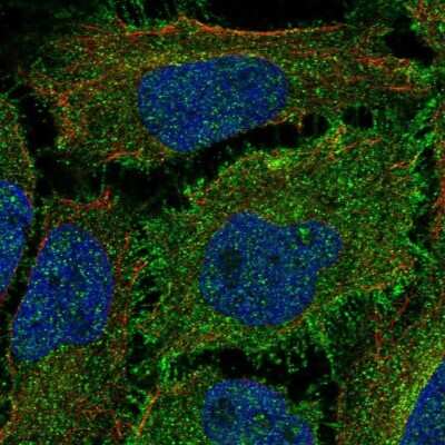 Immunocytochemistry/ Immunofluorescence: ROBO1 Antibody [NBP2-68981]