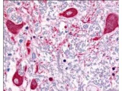 Immunohistochemistry: ROBO1 Antibody [NB600-1254]