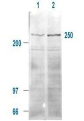 Western Blot: ROBO1 Antibody [NB600-1254]