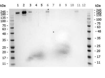 Western Blot: ROBO1 Antibody [NB600-1254]