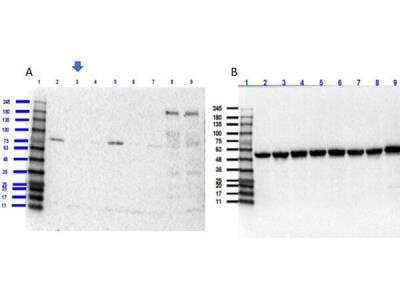 Western Blot: ROBO1 Knockout A549 Cell Lysate [NBP3-18631]