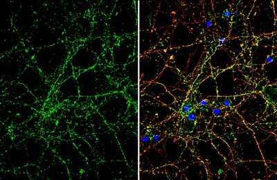 Immunocytochemistry/ Immunofluorescence: ROBO2 Antibody [NBP3-13364]