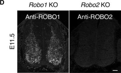 Immunohistochemistry: ROBO2 Antibody [NBP1-81399]