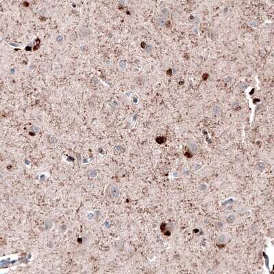Immunohistochemistry-Paraffin: ROBO2 Antibody [NBP1-81399]