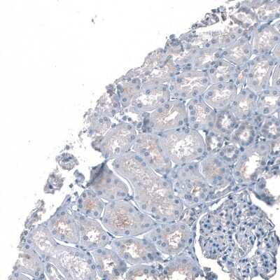 Immunohistochemistry-Paraffin: ROBO2 Antibody [NBP1-81399]