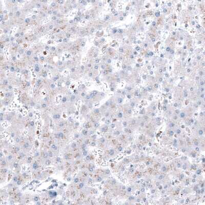 Immunohistochemistry-Paraffin: ROBO2 Antibody [NBP1-81399]