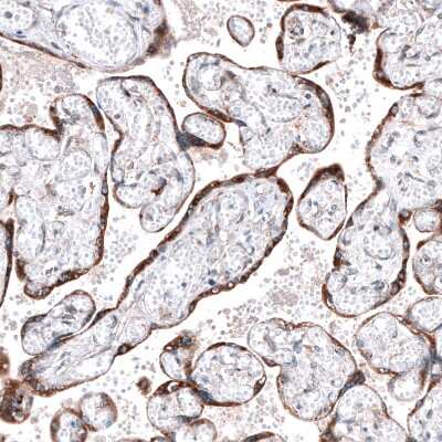 Immunohistochemistry-Paraffin: ROBO2 Antibody [NBP1-81399]