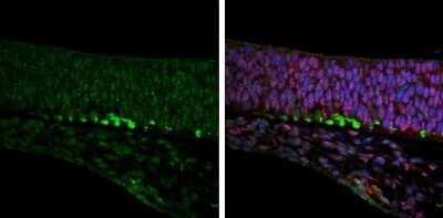 Immunohistochemistry-Paraffin: ROBO2 Antibody [NBP3-13364]