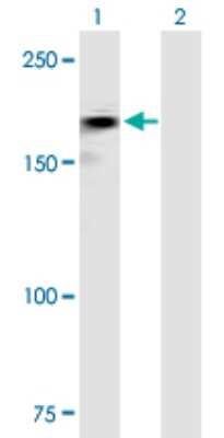 Western Blot: ROBO2 Antibody [H00006092-B01P]