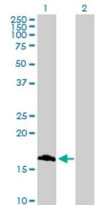 Western Blot: ROBO3 Antibody [H00064221-B02P]